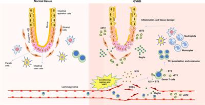 Biomarkers for early complications post hematopoietic cell transplantation: Insights and challenges